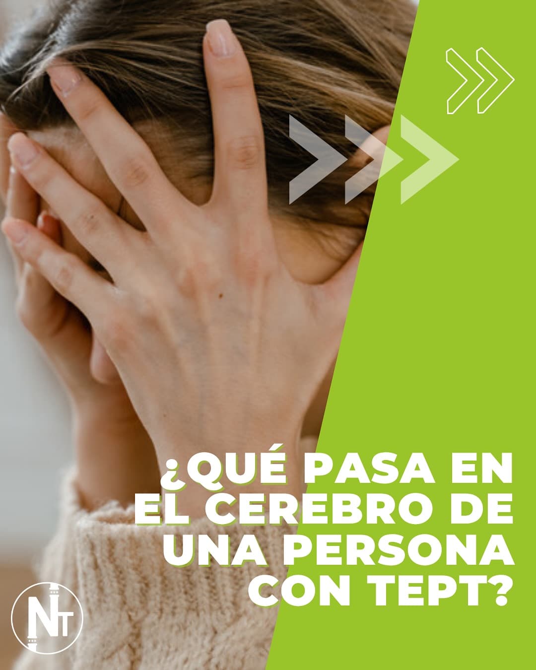 El Estrés Postraumático (TEPT) en Argentina: Afecta al 2.8% de nuestra población tras vivir un evento traumático. ��